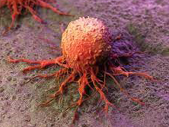 Solid Tumors